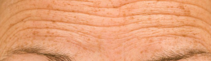 As we age our skin forms wrinkles due to loss of elastin and collagen.