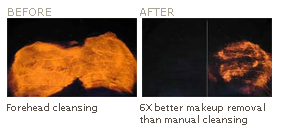 Before and after - Sonic Cleansing System For Cleaner Skin