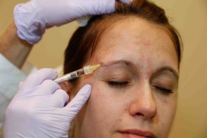 Dermal Filler Technique